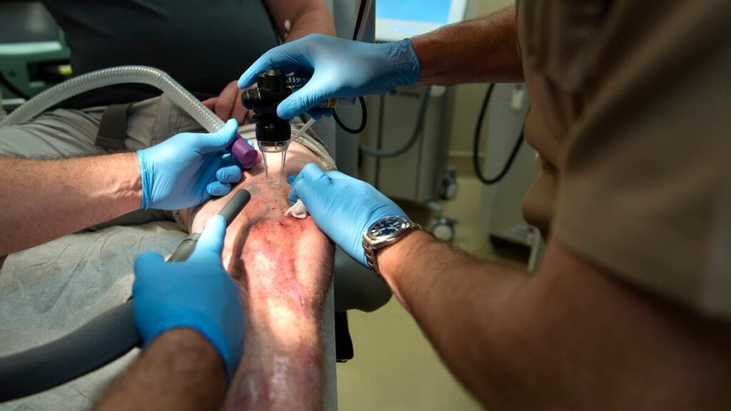 Errors in disability cases for ‘painful scars’ resulted in overpayment: VA watchdog